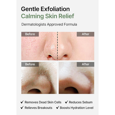 celimax Jiwoogae Heartleaf BHA Peeling Pad 60P Set (+10P)